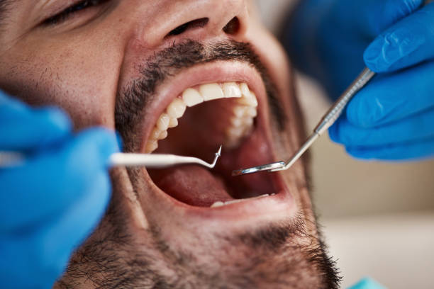 Best Same-Day Emergency Dental Services in Alliae, NC